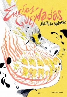 Encías quemadas